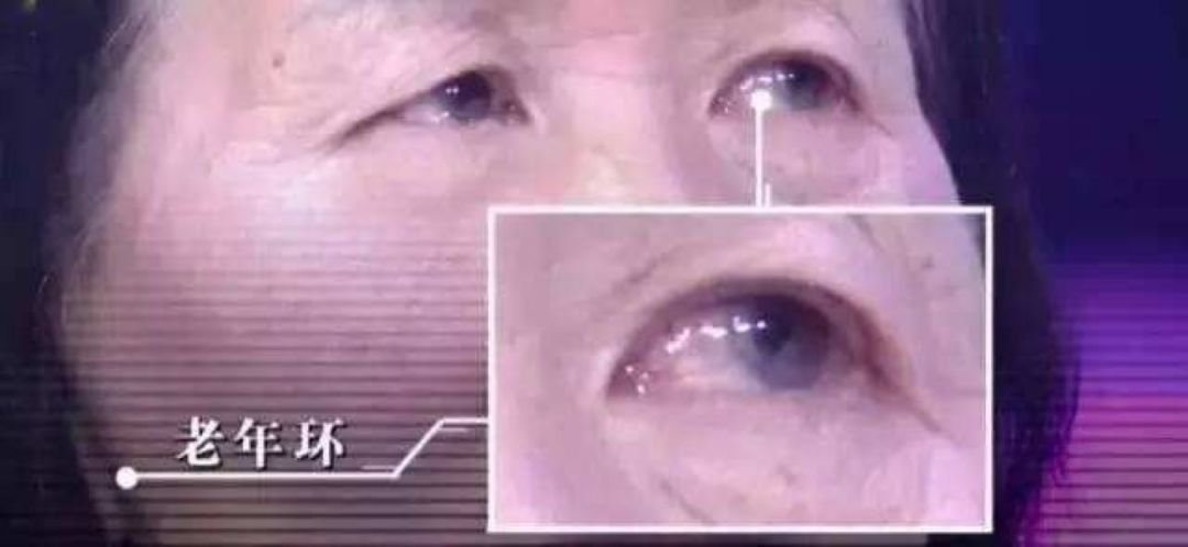 圖片關(guān)鍵詞